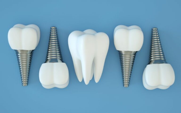 Row of dental implant screws.